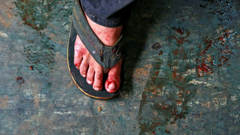 El pie de un carnicero, cubierto de pelo y sangre después del sacrificio de una cabra durante Eid al -Adha en Delhi, India. REUTERS/Cathal McNaughton