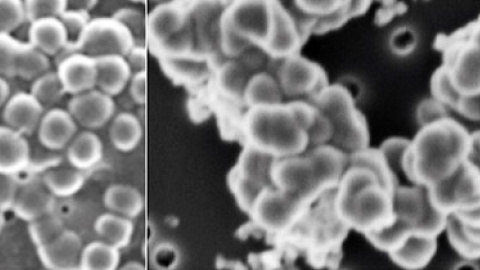 Células microbianas (izquierda) pueden ser fácilmente confundidas con precipitados minerales ricos en sílice (derecha). / Karim Benzerara, Puri López-García et al.