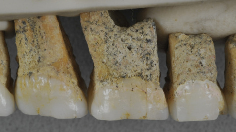 Dentadura superior derecha de Homo luzonensis | Callao Cave Archaelogy Projet