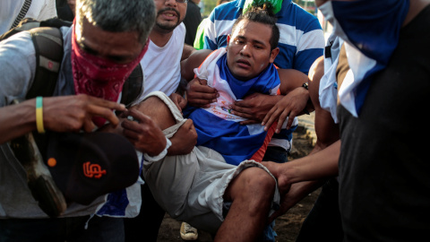 Uno de los heridos durante las protestas - REUTERS