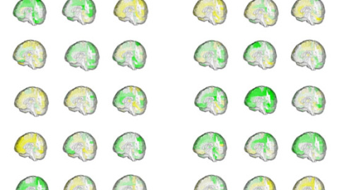 Diferentes volúmenes (verde=grande, amarillo=pequeño) de las regiones del cerebro en 42 adultos que muestran la coincidencia entre las formas de los cerebros de las mujeres y los cerebros de los hombres.