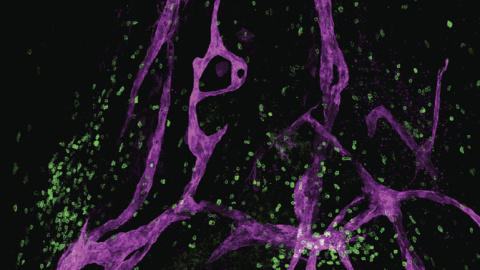 Para sorpresa de los científicos, se ha descubierto que el sistema linfático también actúa en el cerebro. / Jonathan Kipnis and Antoine Louveau