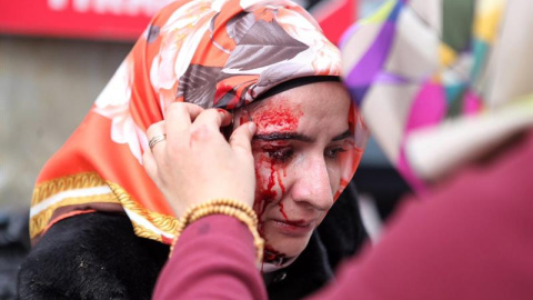 Una mujer, herida tras la carga policial contra los manifestantes que protestaron este sábado por el cierre del diario 'Zaman', en Turquía. EFE/EPA/USAME ARI/ZAMAN NEWSPAPER