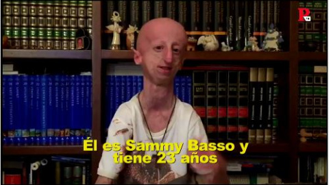 Sammy Basso, el joven con progeria que ha investigado sobre su propia enfermedad