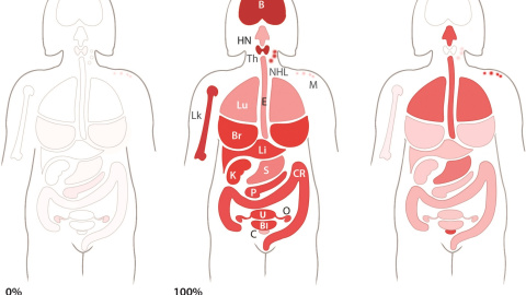 Distinto origen (ambiente, errores en la división celular y herencia, de izquierda a derecha)  en porcentaje de mutaciones relacionadas con 18 tipos de cáncer en mujeres, según un código de color. –THE JOHNS HOPKINS UNIVERSITY