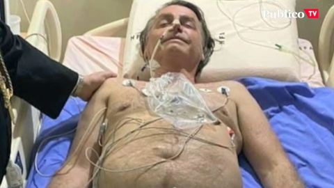 Bolsonaro, hospitalizado por fuertes dolores abdominales