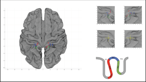 Variabilidad interindividual de la corteza somatosensorial genital.