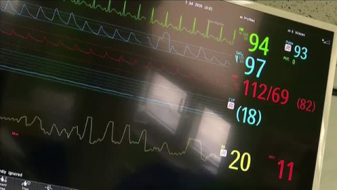 La ONU propone que se aplique una renta mínima durante la pandemia ante el descontrol mundial del Covid-19