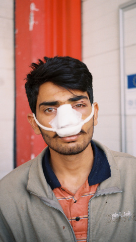 Joven de 17 años al día siguiente de ser deportado desde Croacia. Foto tomada en el campamento de Miral, Bosnia.