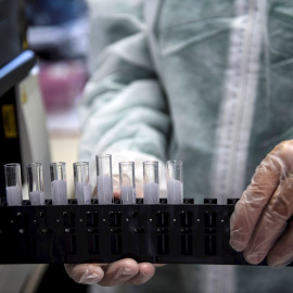 Un médico manipula unas muestras en un laboratorio, en una imagen de archivo. EFE/EPA/Julien de Rosa