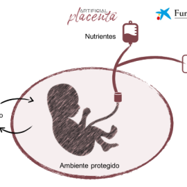 Infografía de la placenta artificial