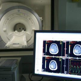 Vista d'un escàner a un centre de tractament d'Alzheimer, en una imatge d'arxiu