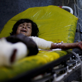 Niño en hospital de Sanaa