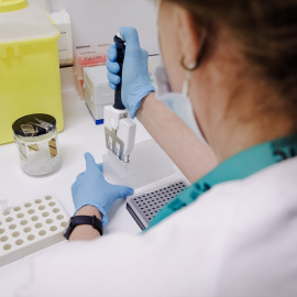 Imagen de archivo de una técnico de laboratorio preparando una PCR para el análisis de la viruela del mono.