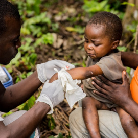 Un niño de República Centroafricana contagiado por la viruela del mono es atendido por un sanitario.