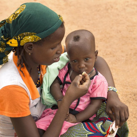 Una madre da de comer a su hijo desnutrido en Burkina Faso.