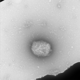 06/06/2022-Partículas virales del virus del mono observadas por microscopia electrónica de transmisión directamente del líquido obtenido de pústulas de pacientes infectados.