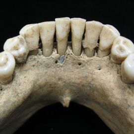 Pigmento de lapislázuli atrapado en el cálculo dental de la mandíbula inferior de una mujer medieval / Christina Warinner