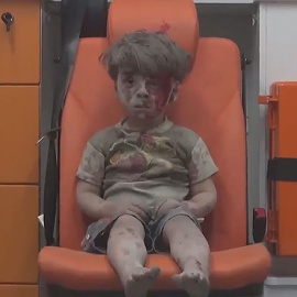 Omar Daqneesh, niño sirio superviviente de un bombardeo, se ha convertido en la imagen de la guerra siria/TWITTER