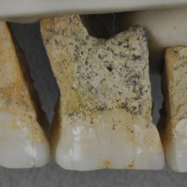 Dentadura superior derecha de Homo luzonensis | Callao Cave Archaelogy Projet