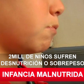 Dos millones de niños sufren desnutrición o sobrepeso